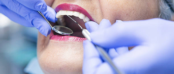 Best Emergency Tooth Extraction  in Buena Park, CA